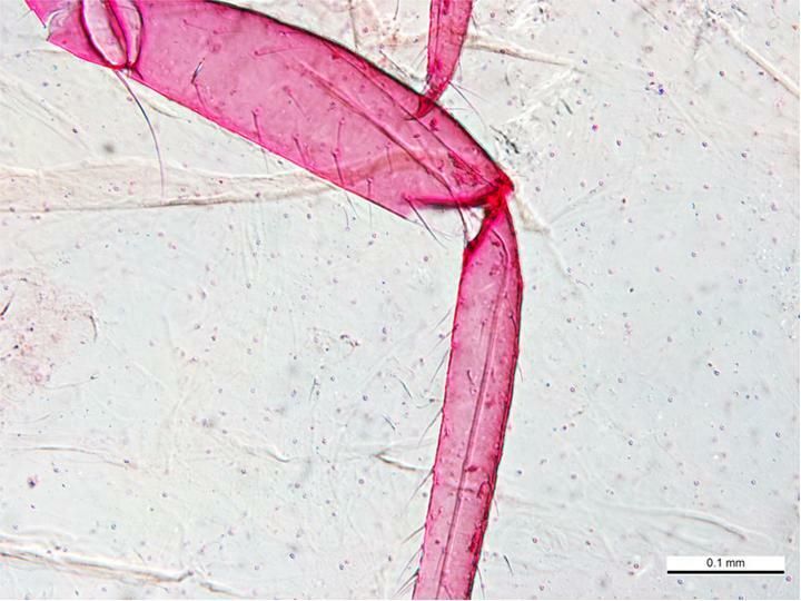 Pseudococcus jackbeardsleyi