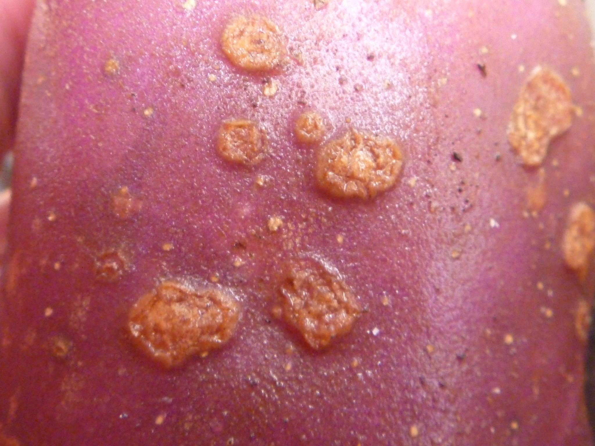 Streptomyces scabiei