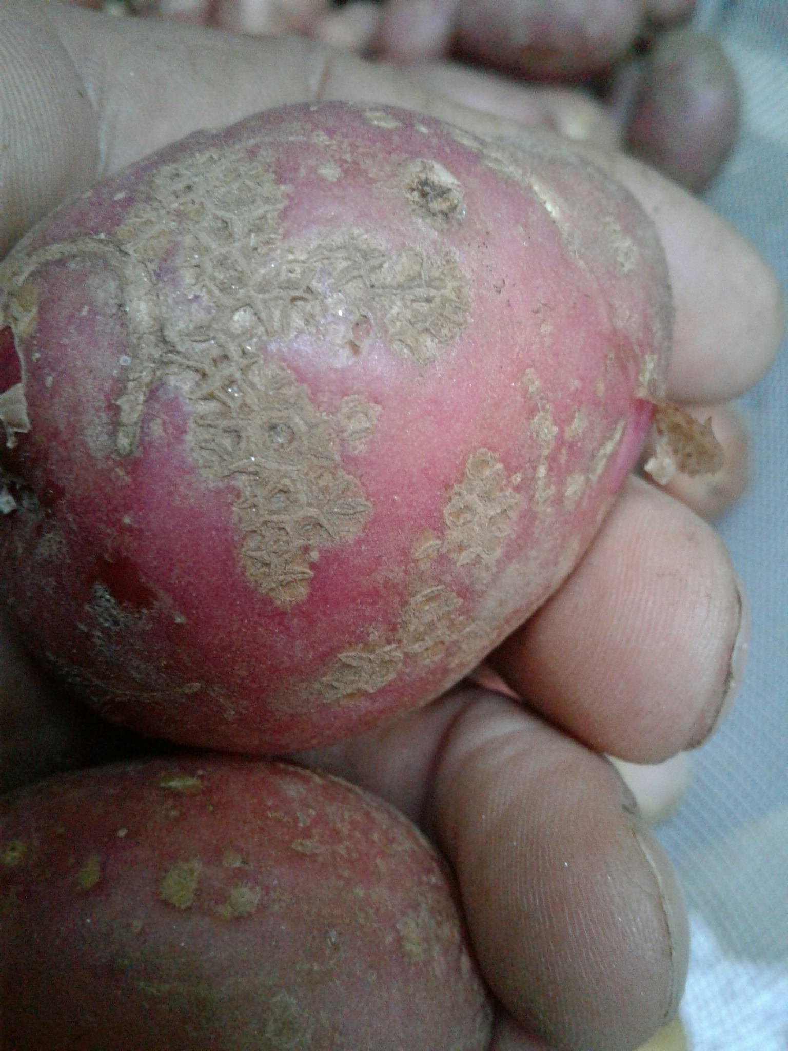 Streptomyces scabiei