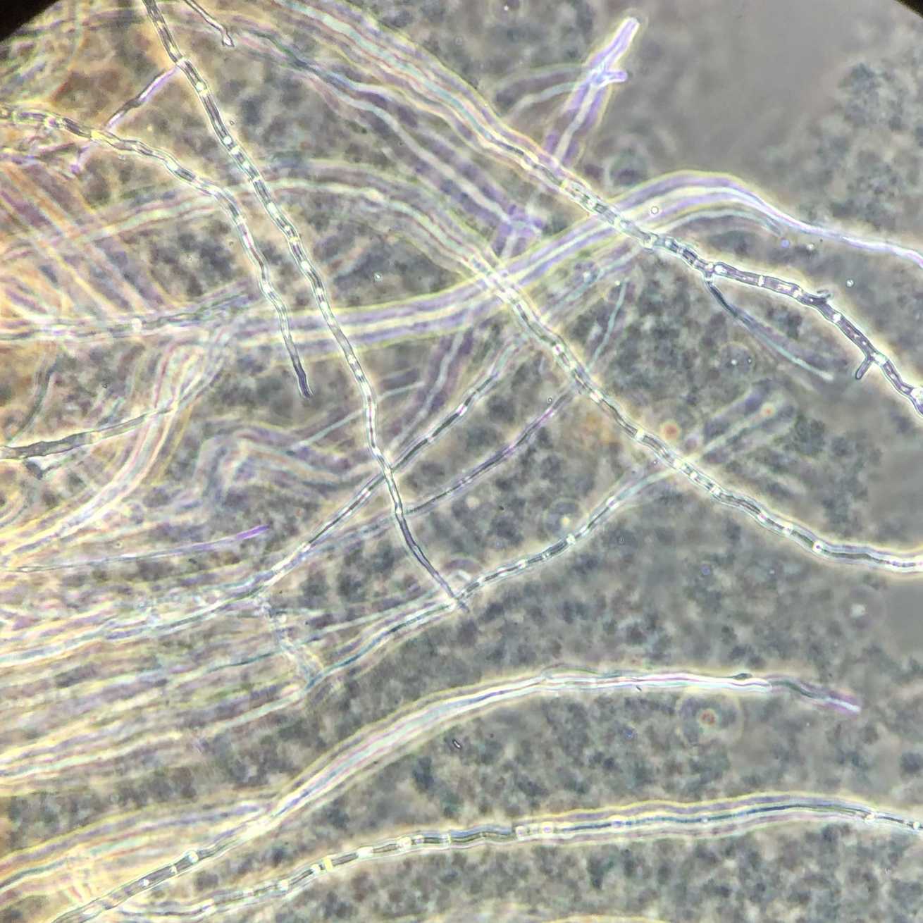 Teratosphaeria molleriana