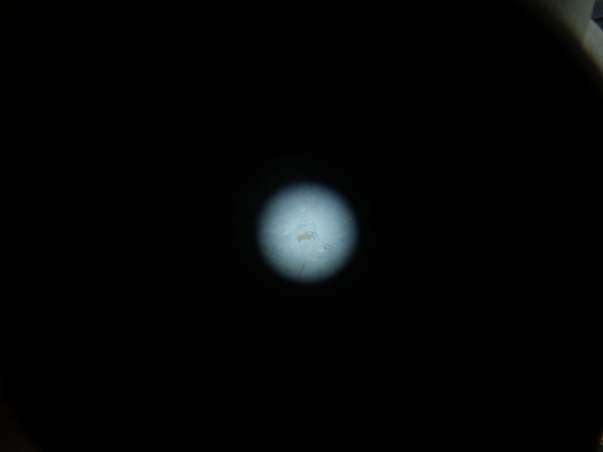 Aleuroglyphus ovatus