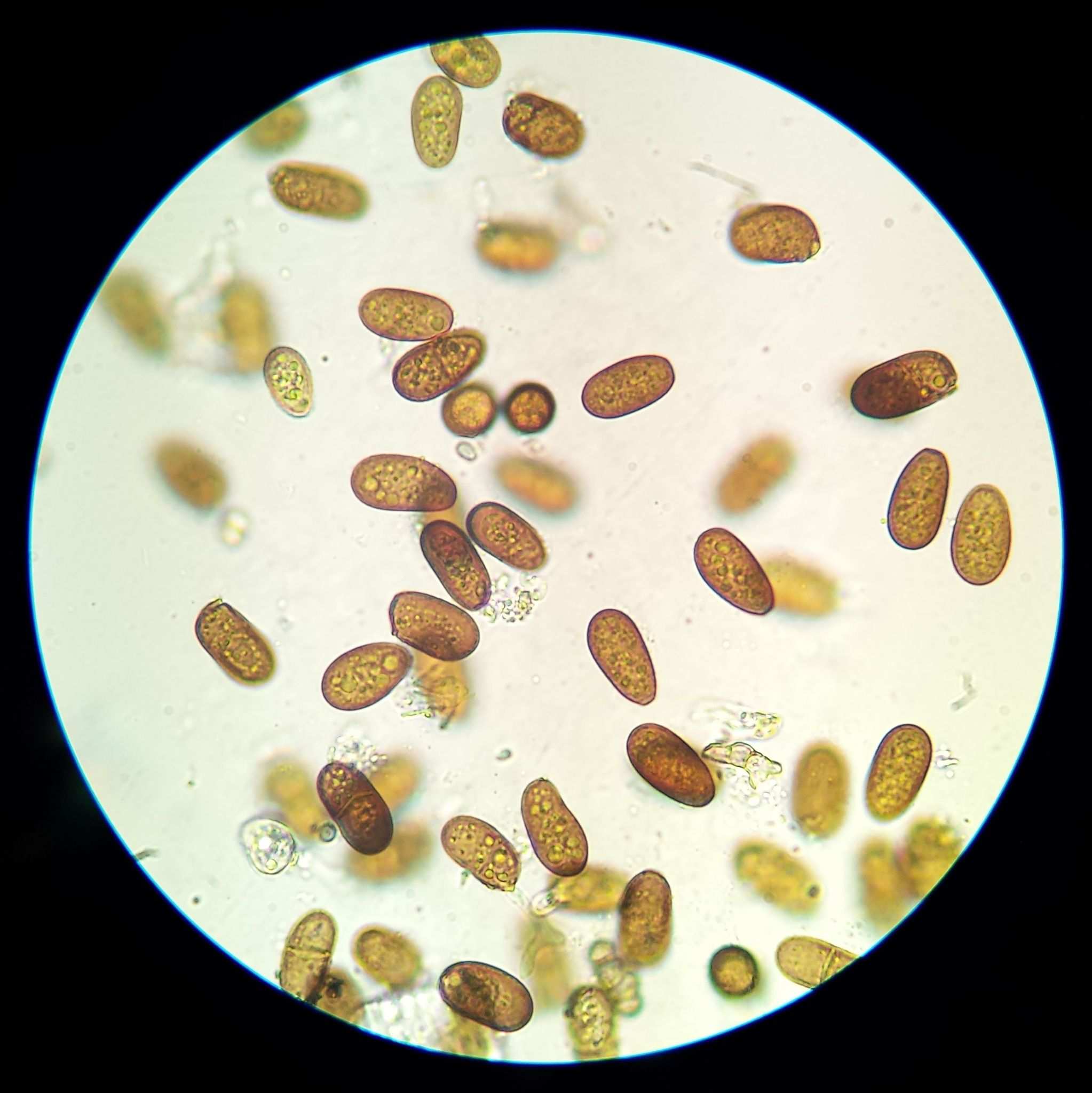 Diplodia seriata