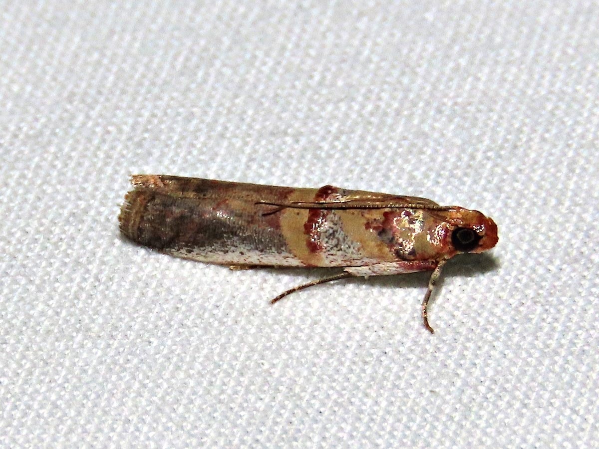 Hypargyria
