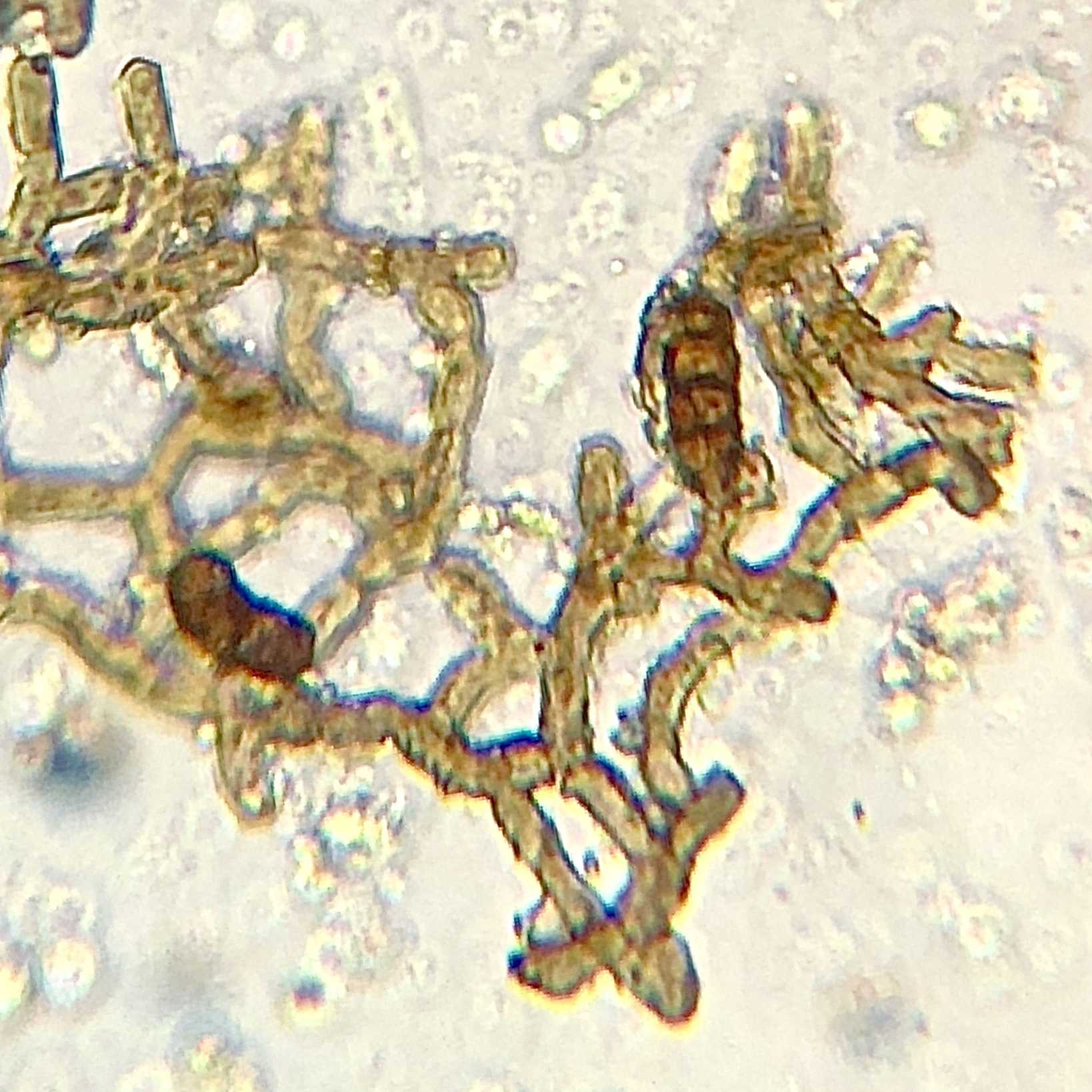Camarosporula