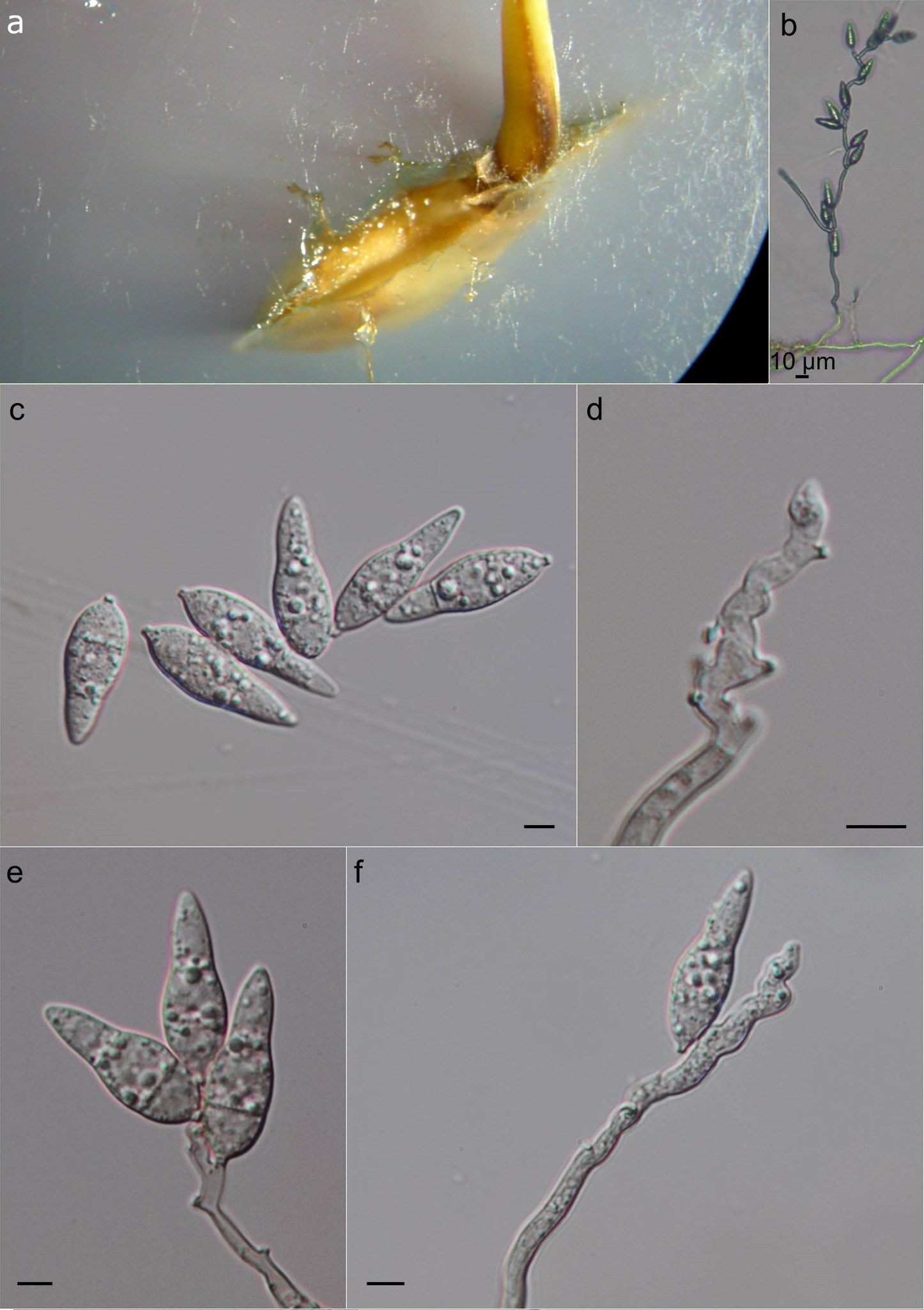 Pyricularia oryzae