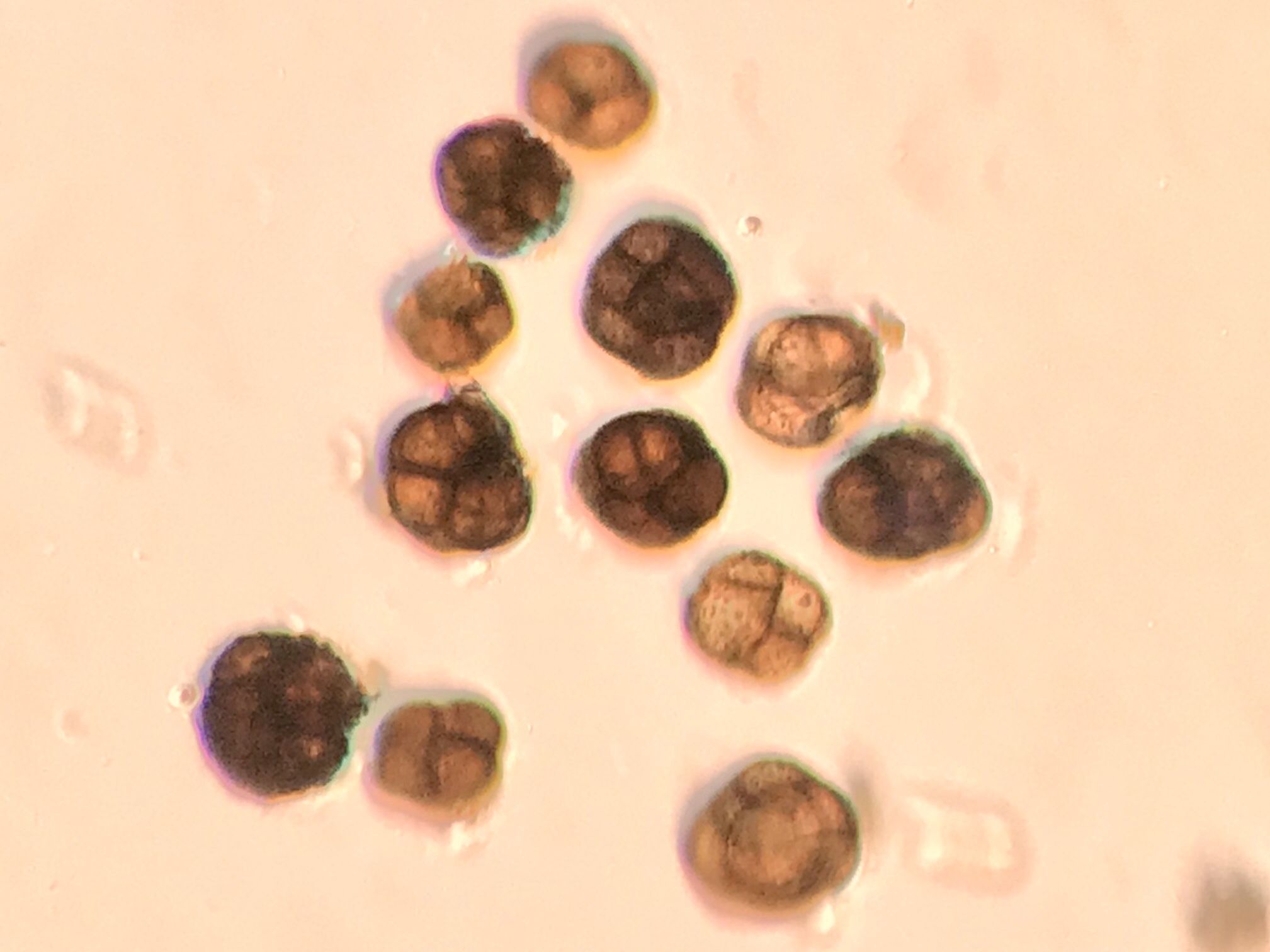 Epicoccum andropogonis