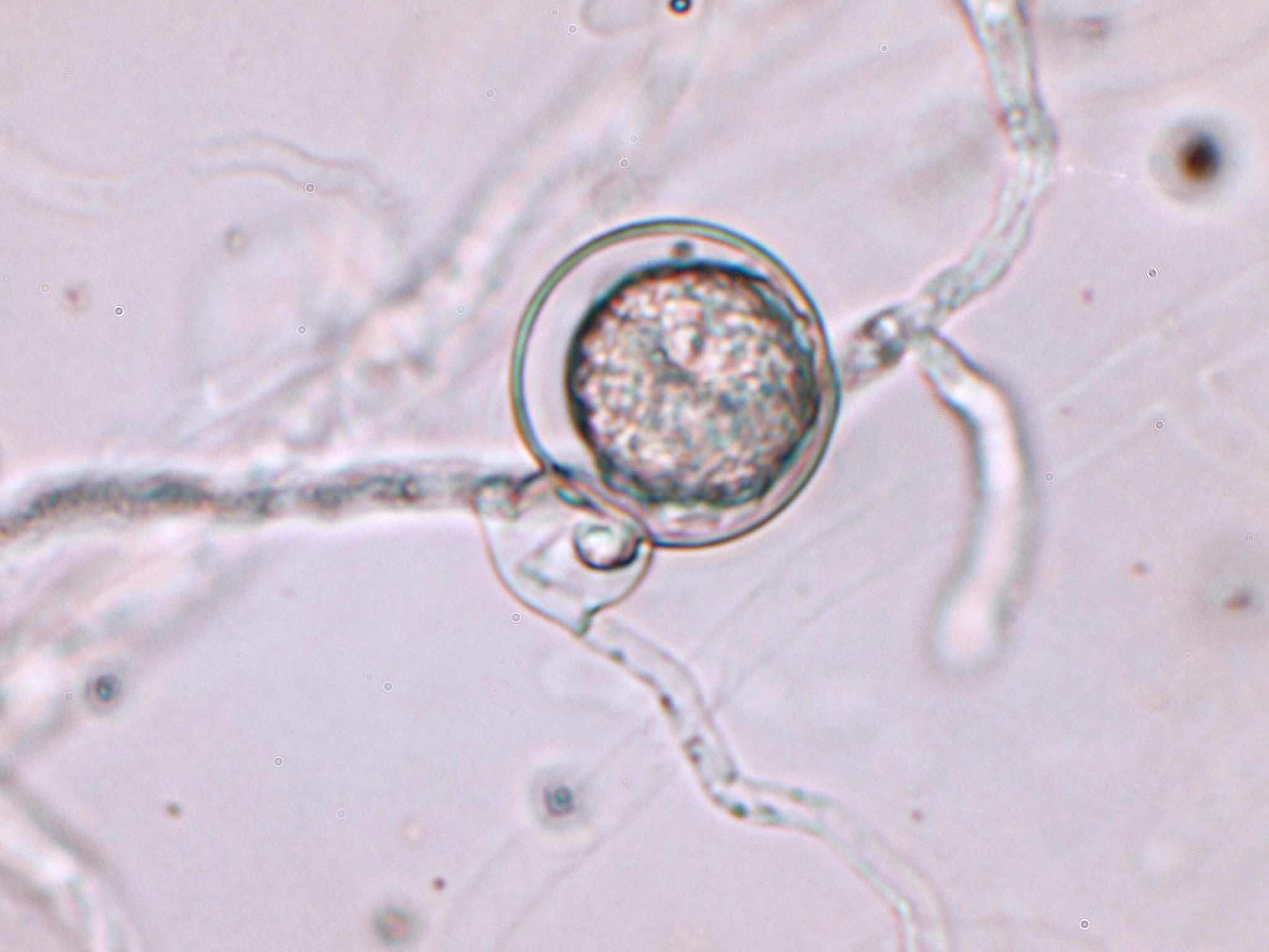 Pythium aphanidermatum