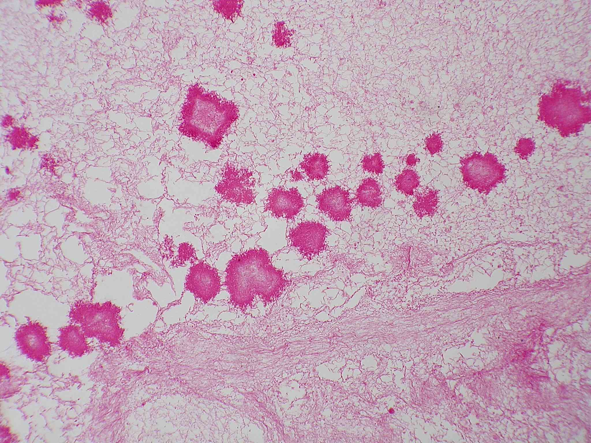 Geotrichum candidum