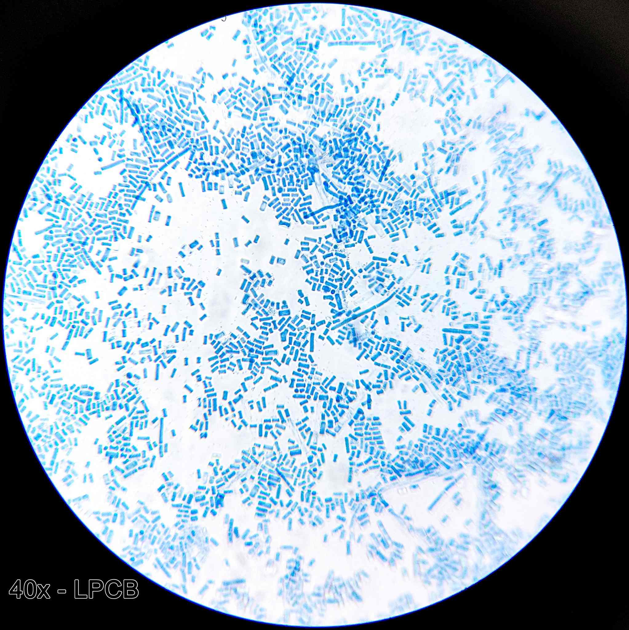 Geotrichum candidum