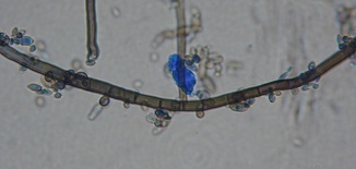 Aureobasidium pullulans