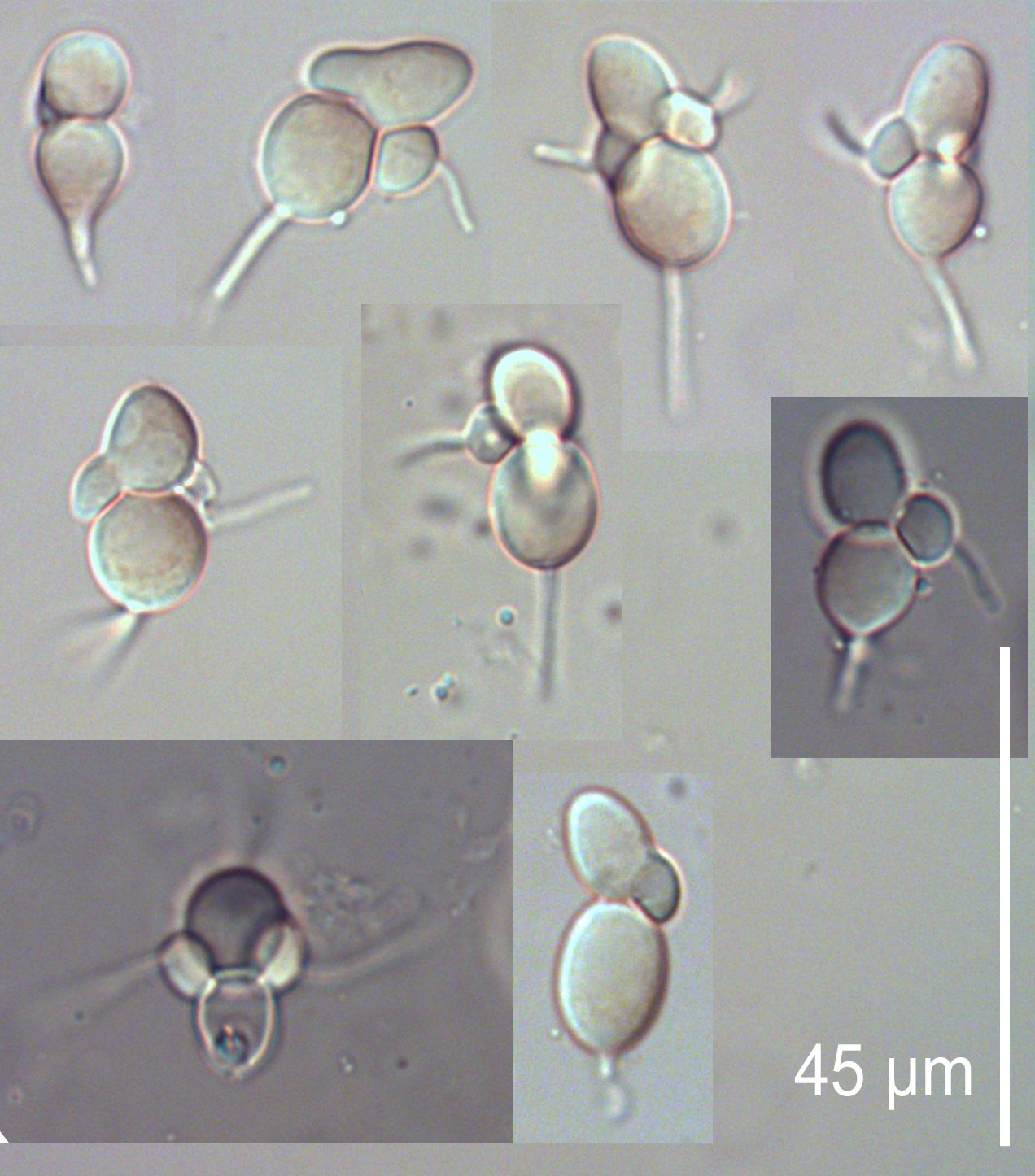Diplocarpon mespili