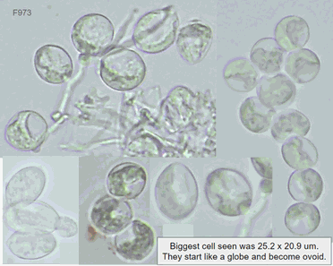 Sclerospora graminicola
