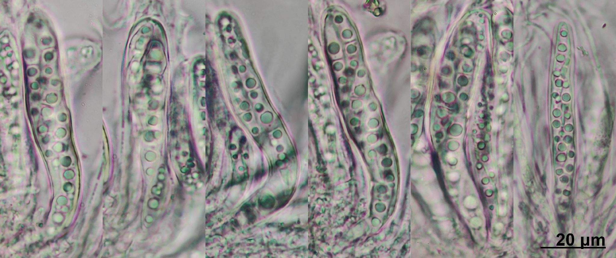 Neovaginatispora fuckelii