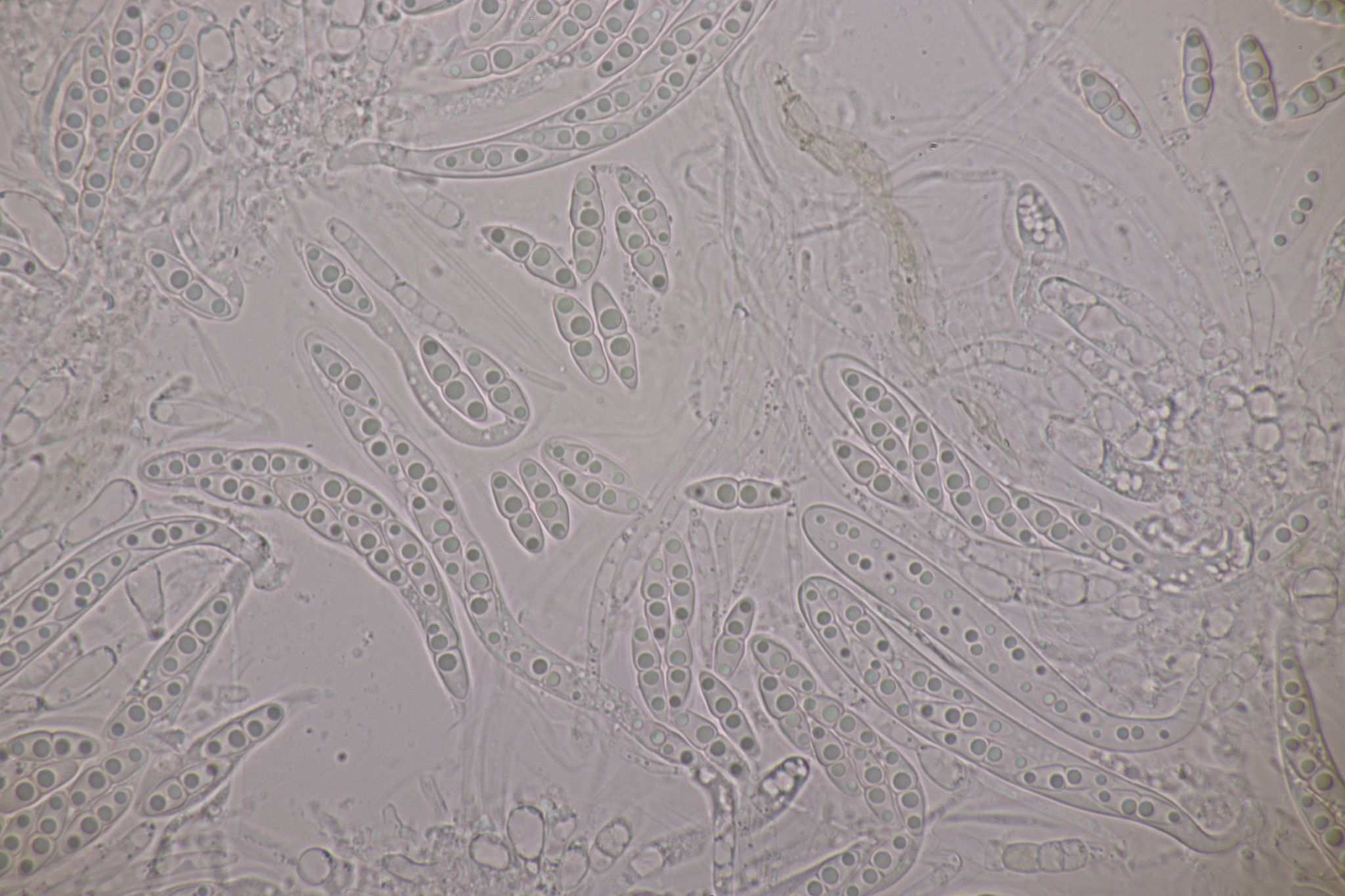 Neovaginatispora fuckelii