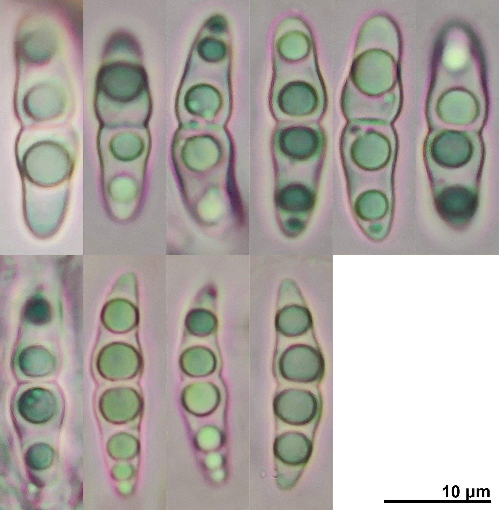 Neovaginatispora fuckelii