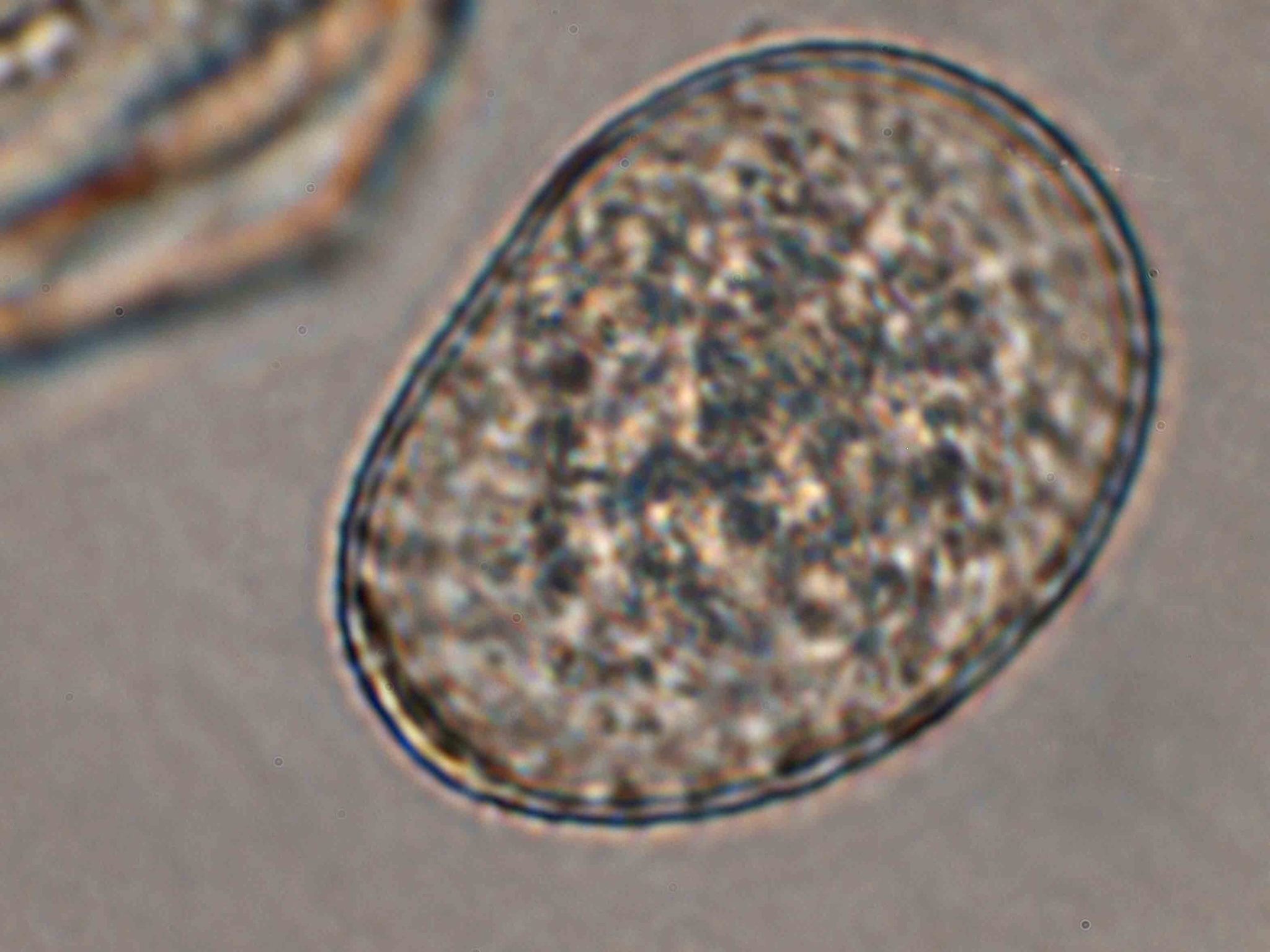 Phakopsora pachyrhizi
