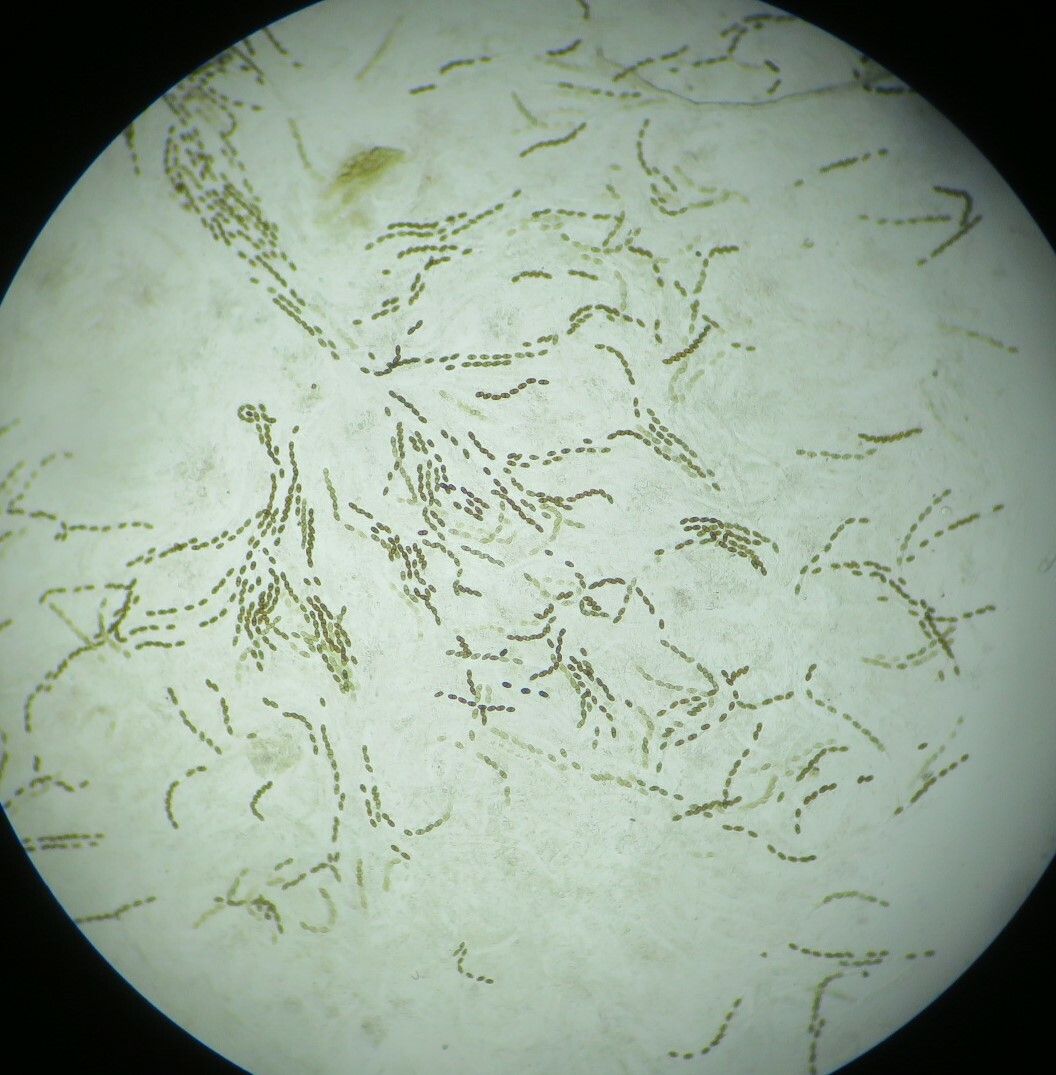 Neofusicoccum ribis