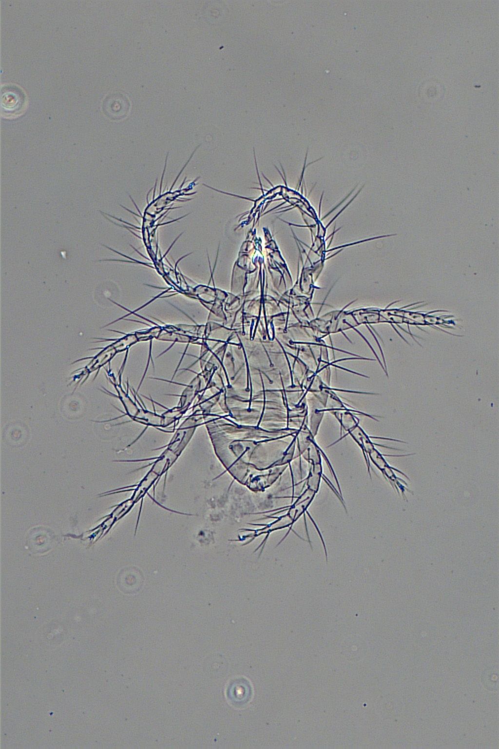 Tetranychus neocaledonicus