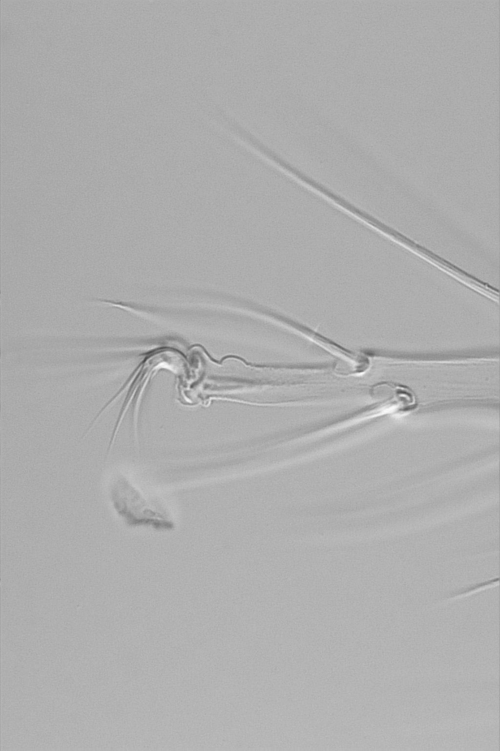 Tetranychus neocaledonicus