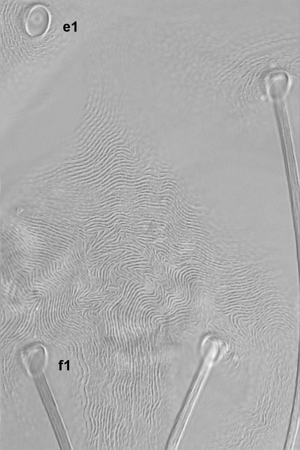 Tetranychus neocaledonicus