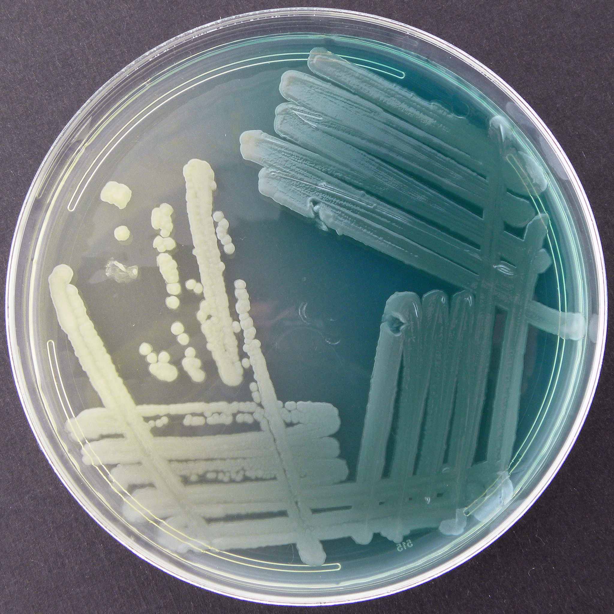 Pseudomonas aeruginosa