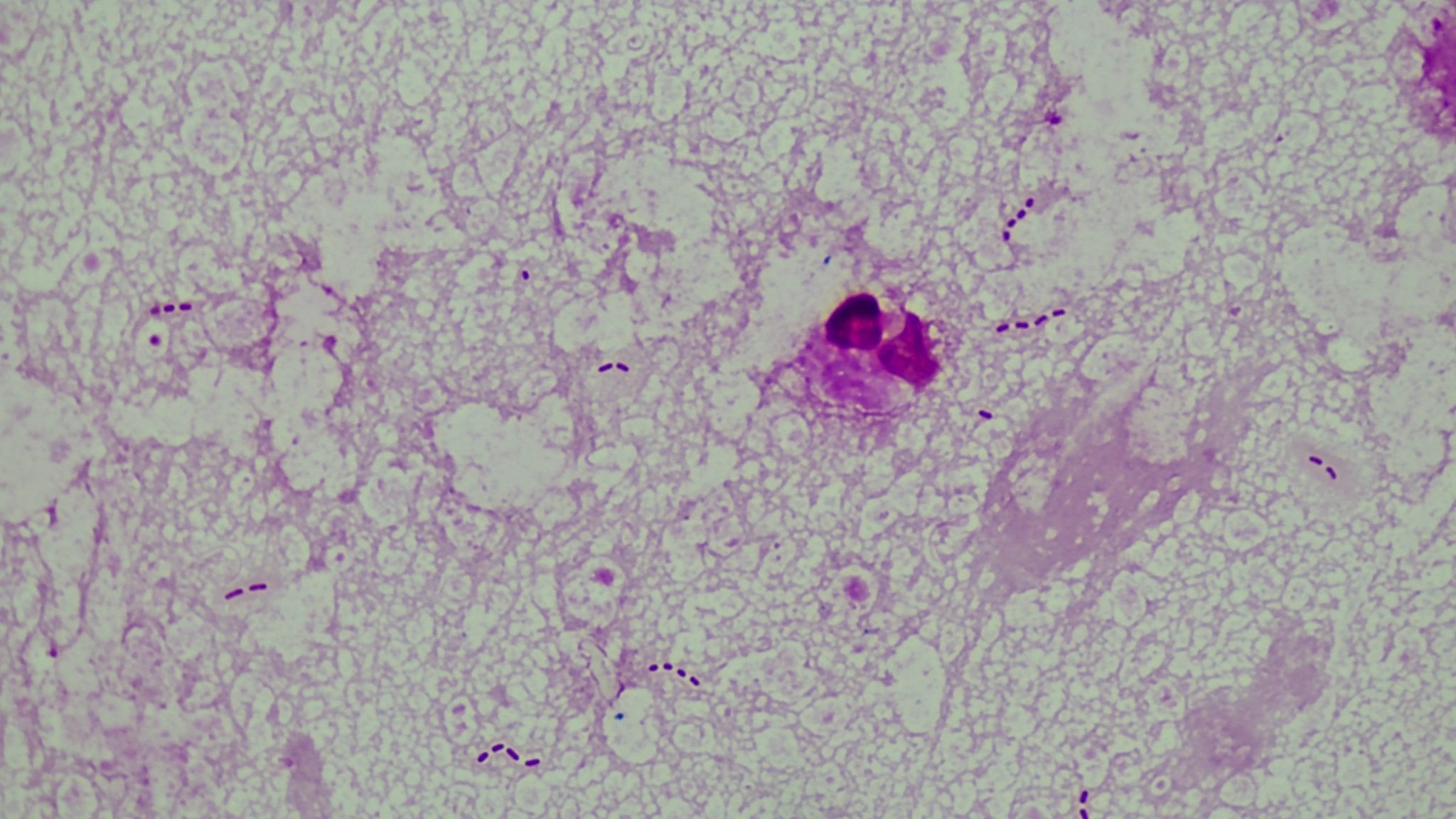 Pseudomonas aeruginosa