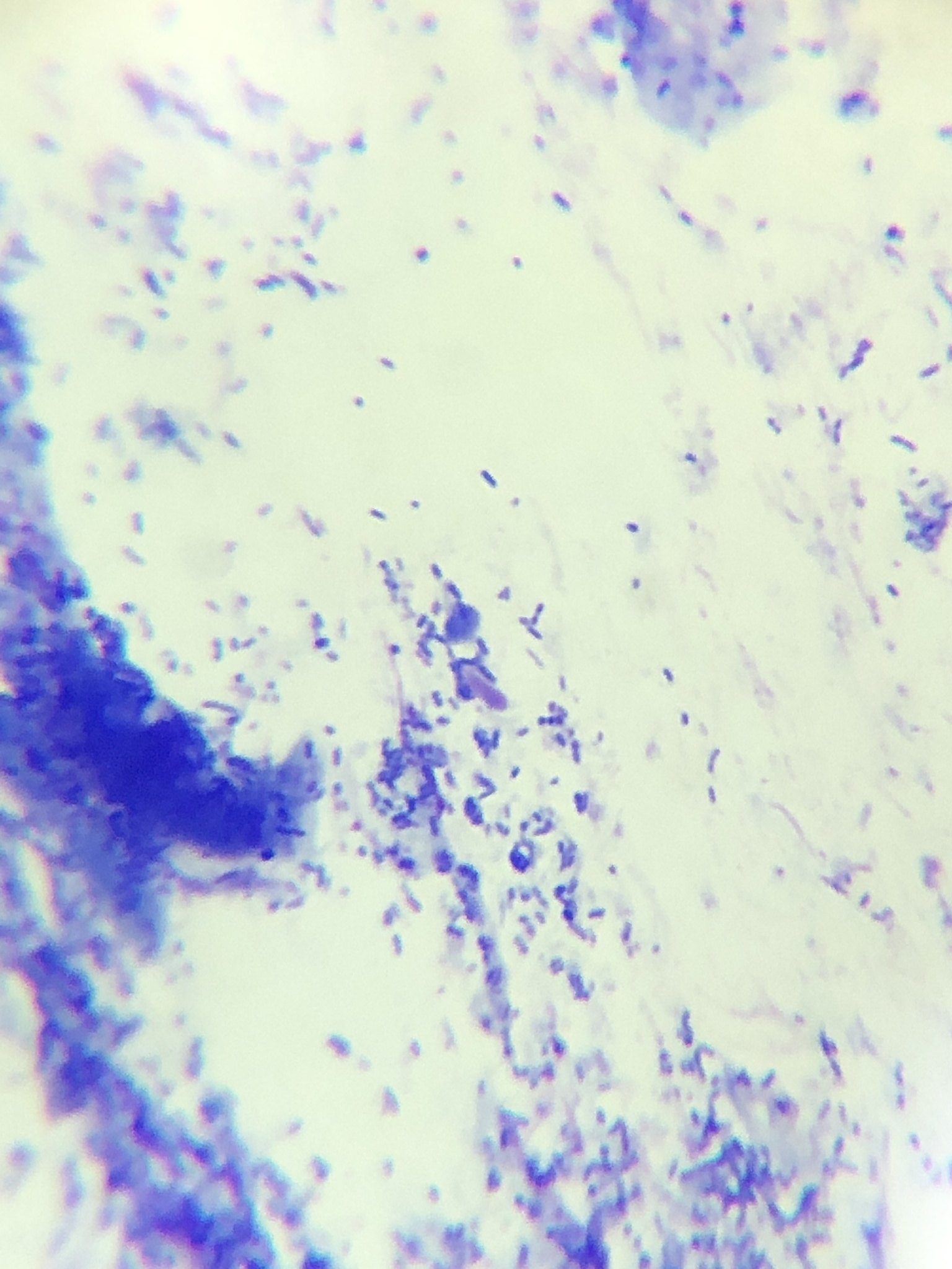 Pseudomonas aeruginosa