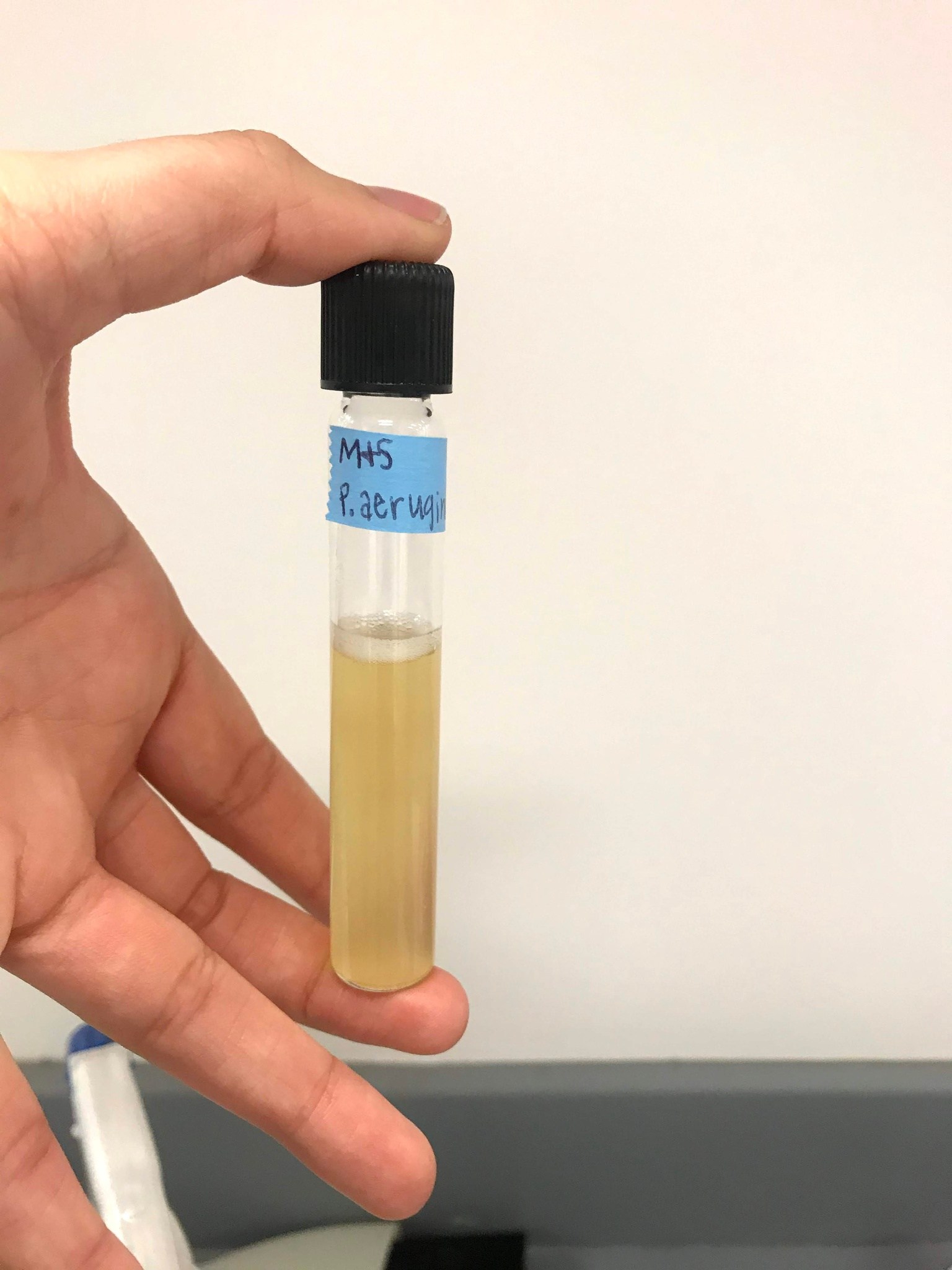 Pseudomonas aeruginosa