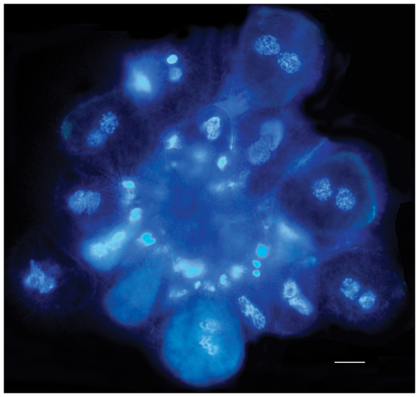 Hemileia vastatrix