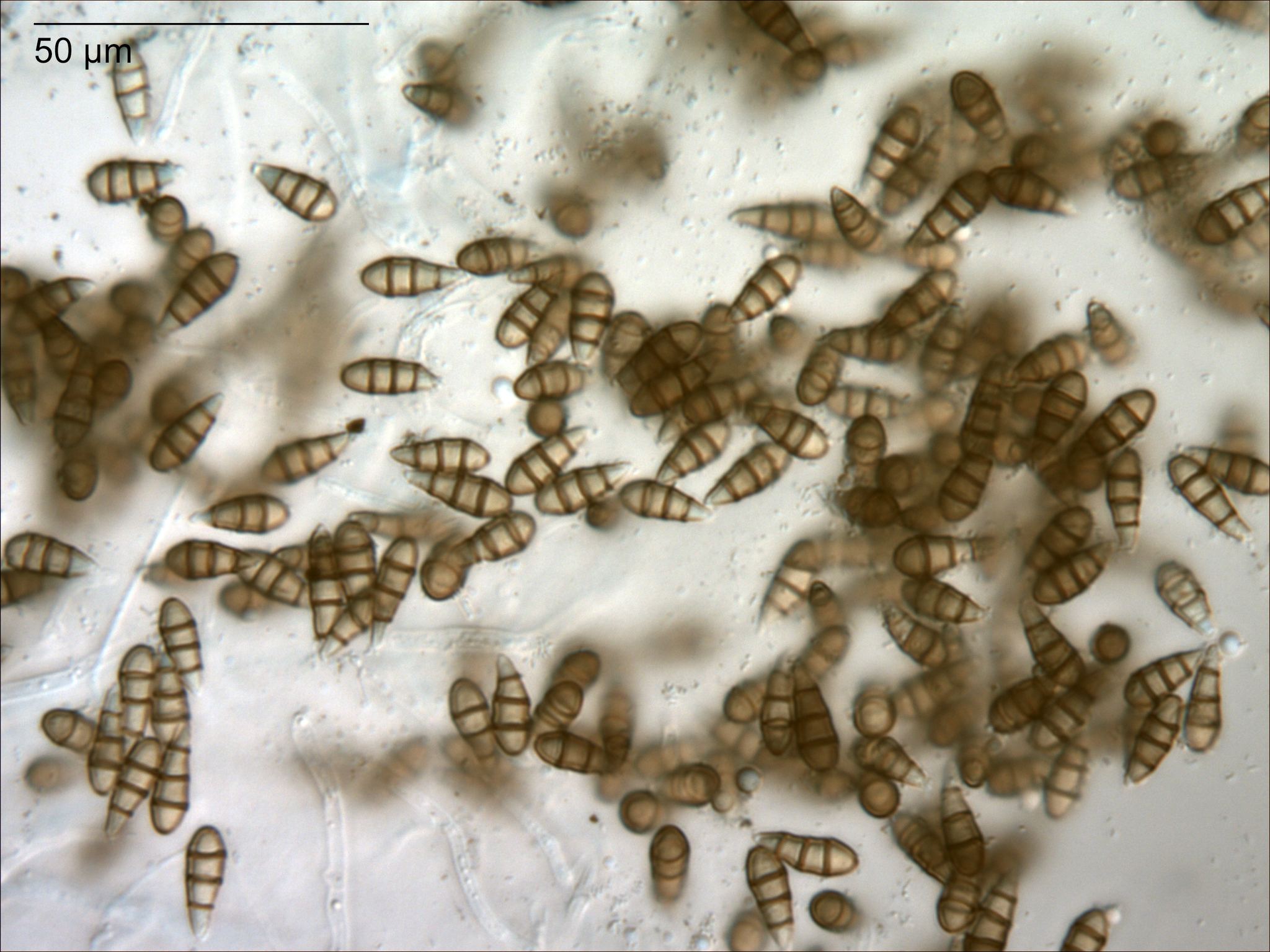 Seimatosporium lichenicola