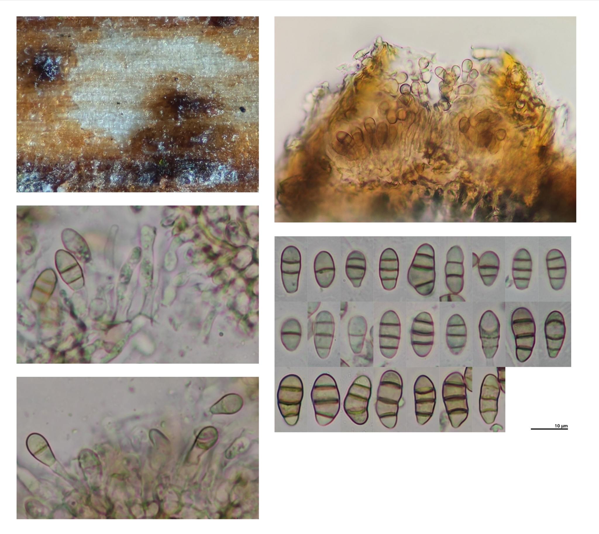 Seimatosporium lichenicola