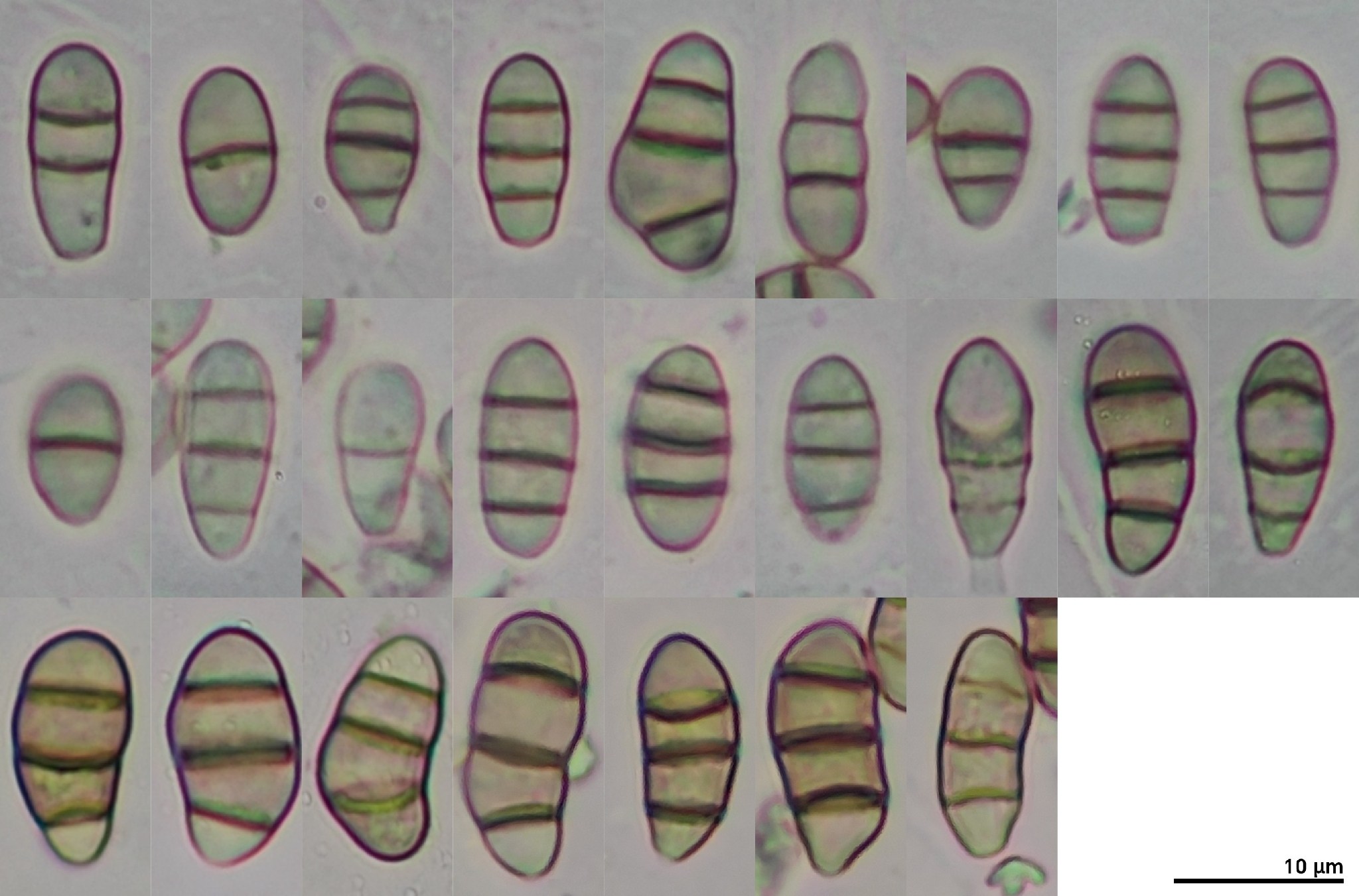 Seimatosporium lichenicola