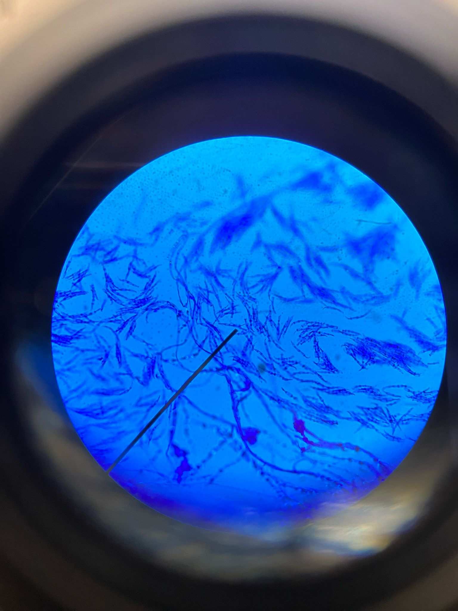 Fusarium equiseti