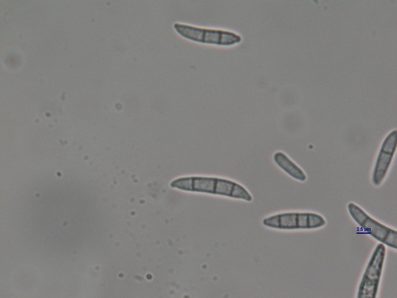 Fusarium equiseti