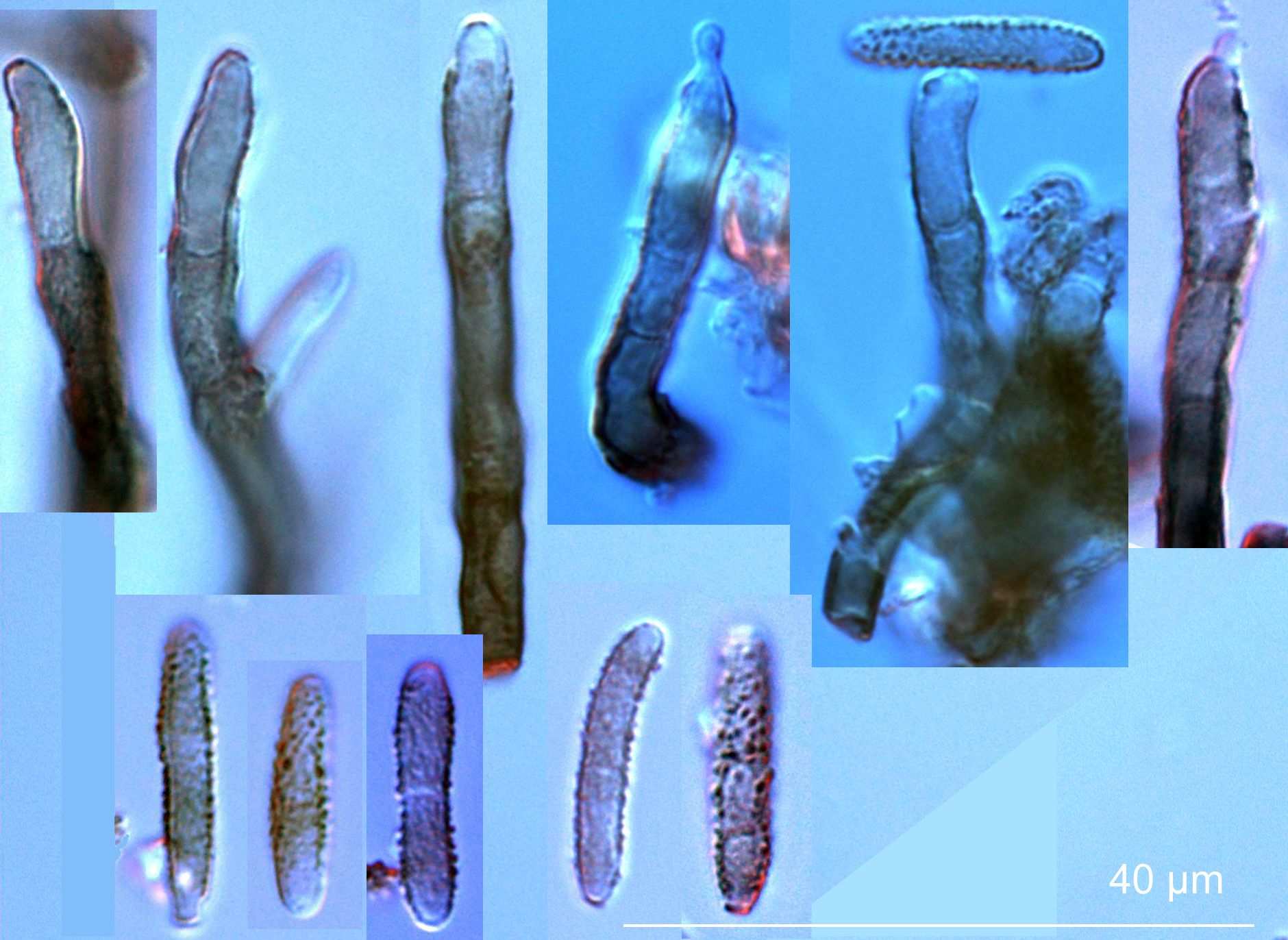 Periconiella