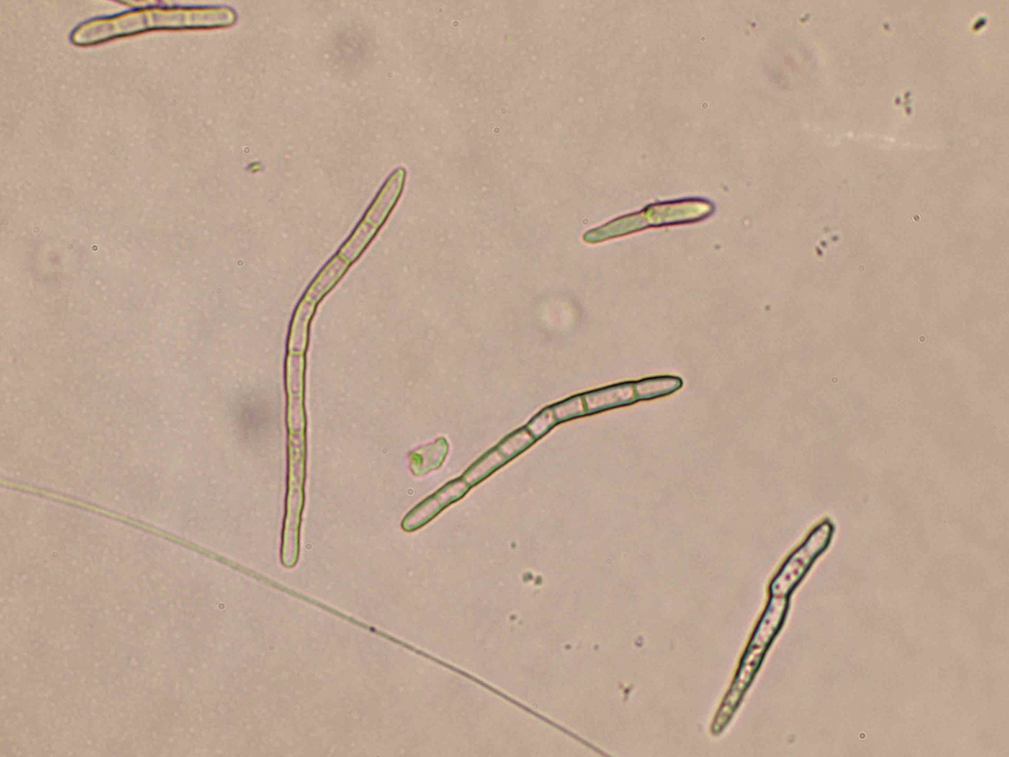 Pseudocercospora fuligena