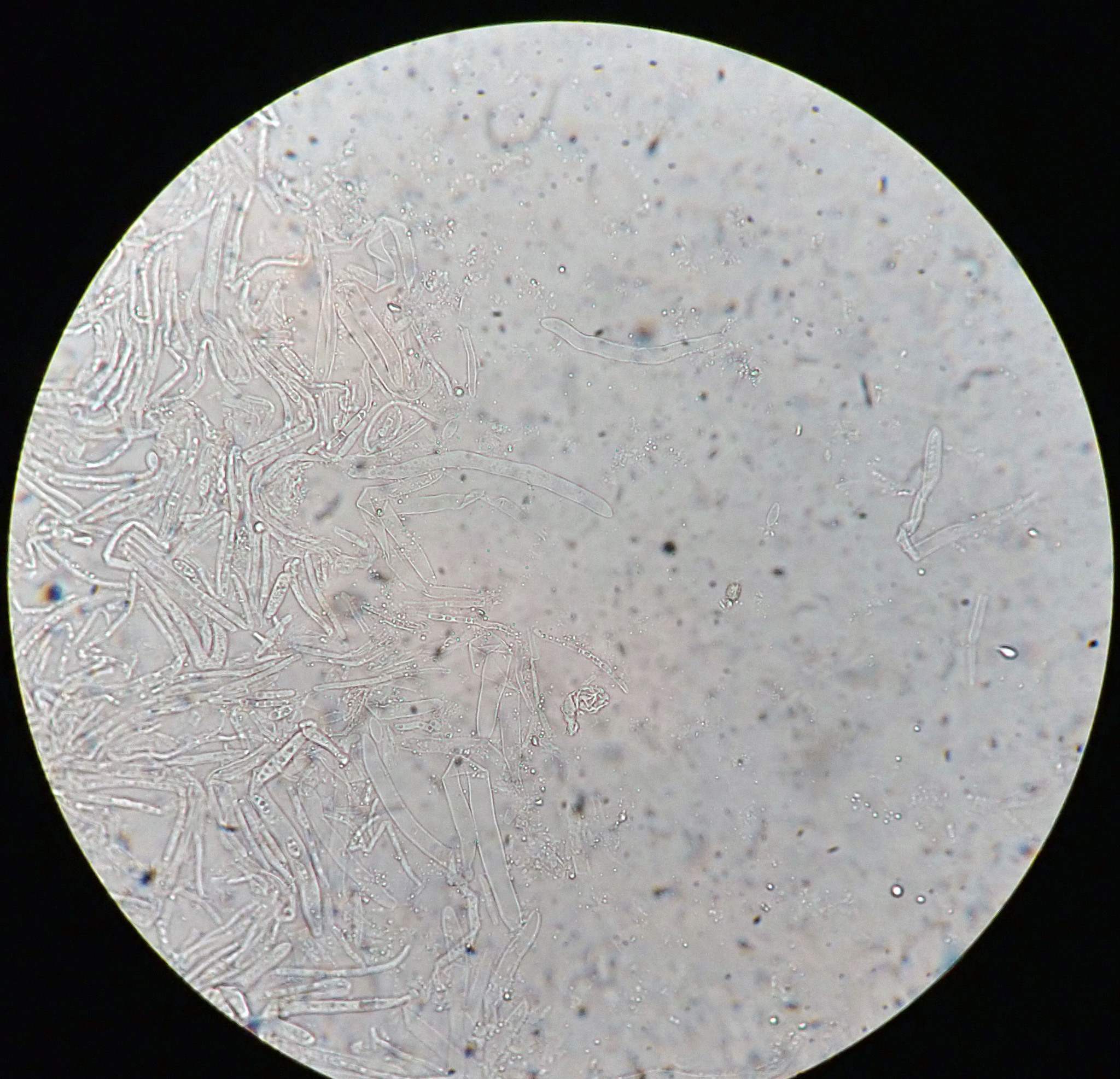 Sclerotinia sclerotiorum