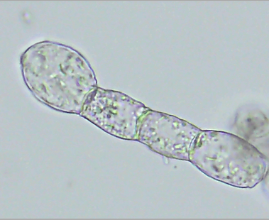 Podosphaera xanthii