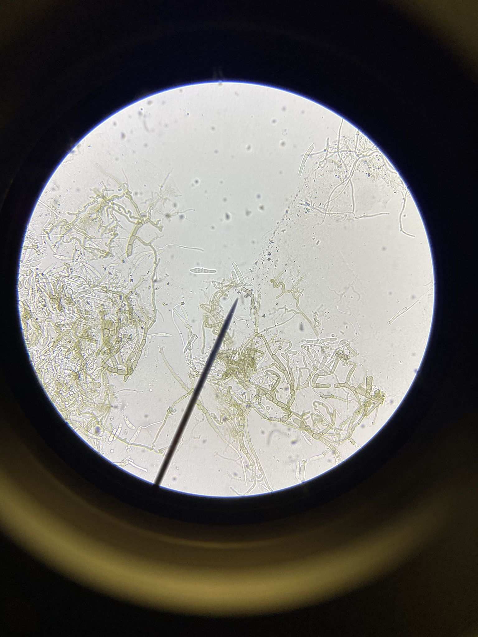Cercospora janseana