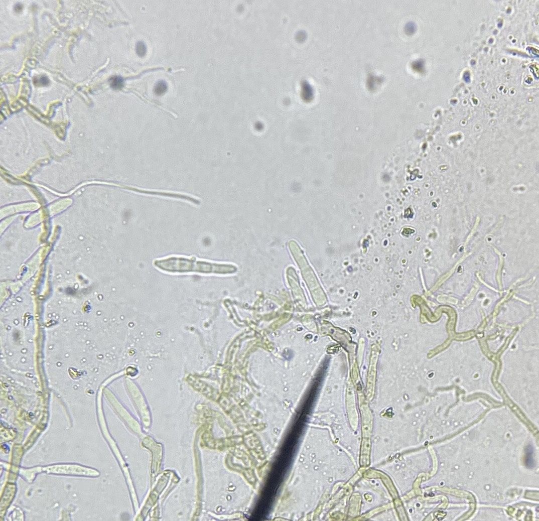 Cercospora janseana