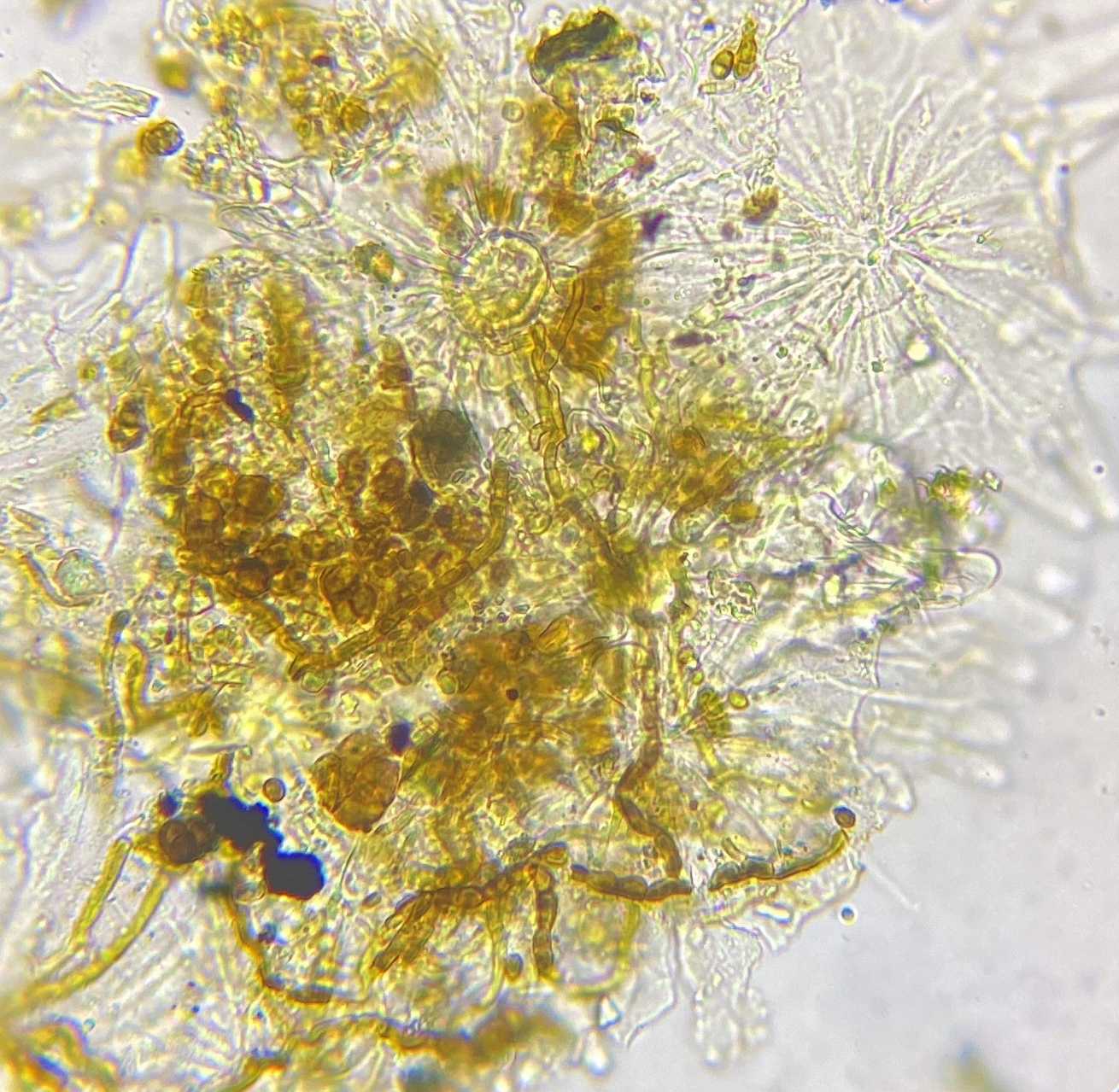 Coleophoma