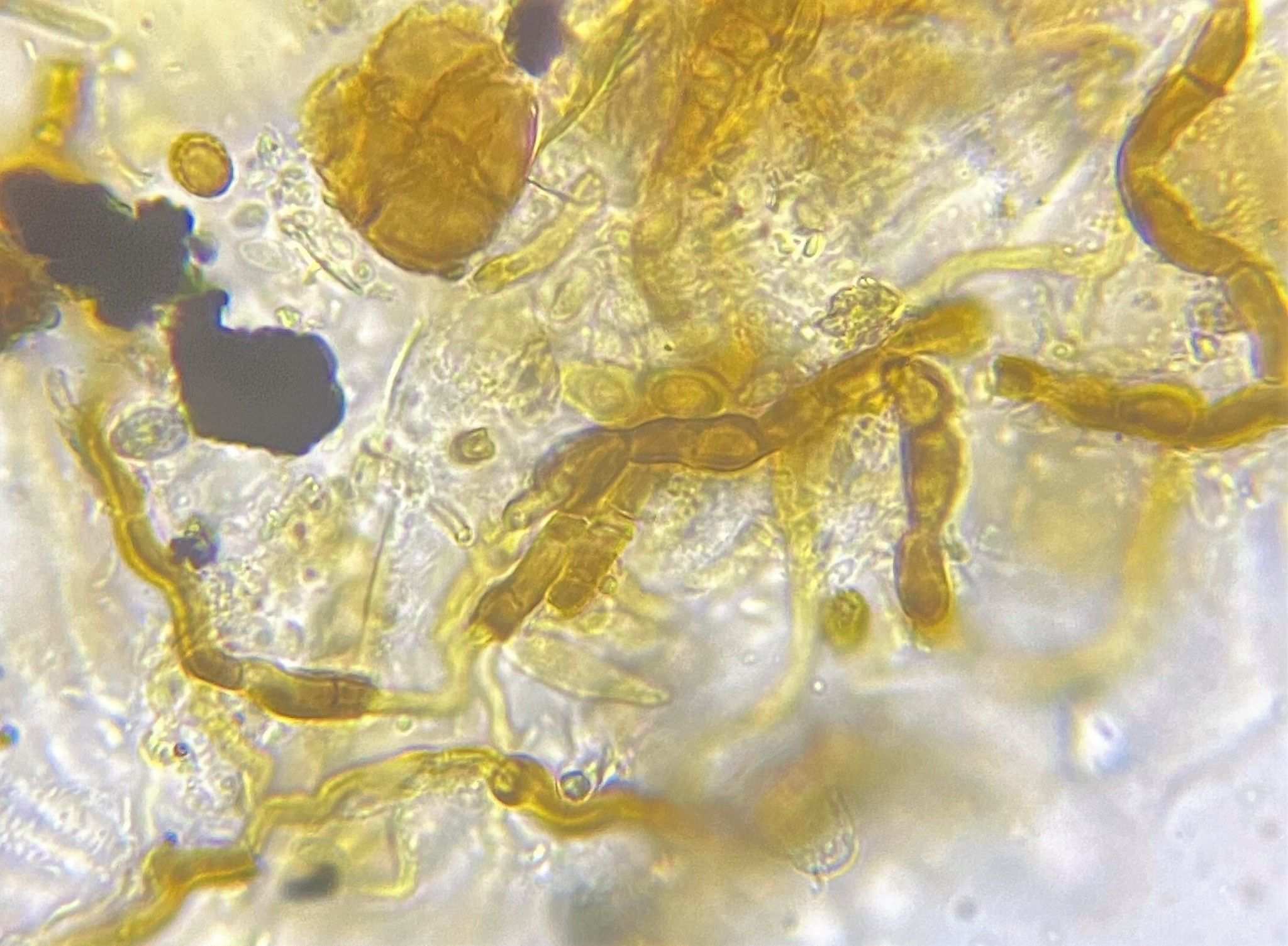 Coleophoma