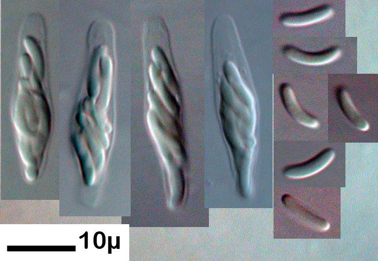 Cytospora ceratosperma