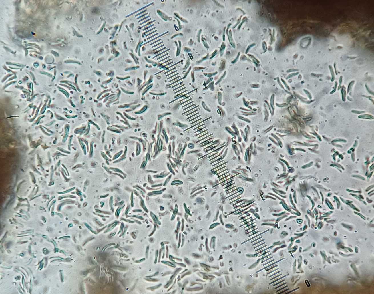 Cytospora ceratosperma