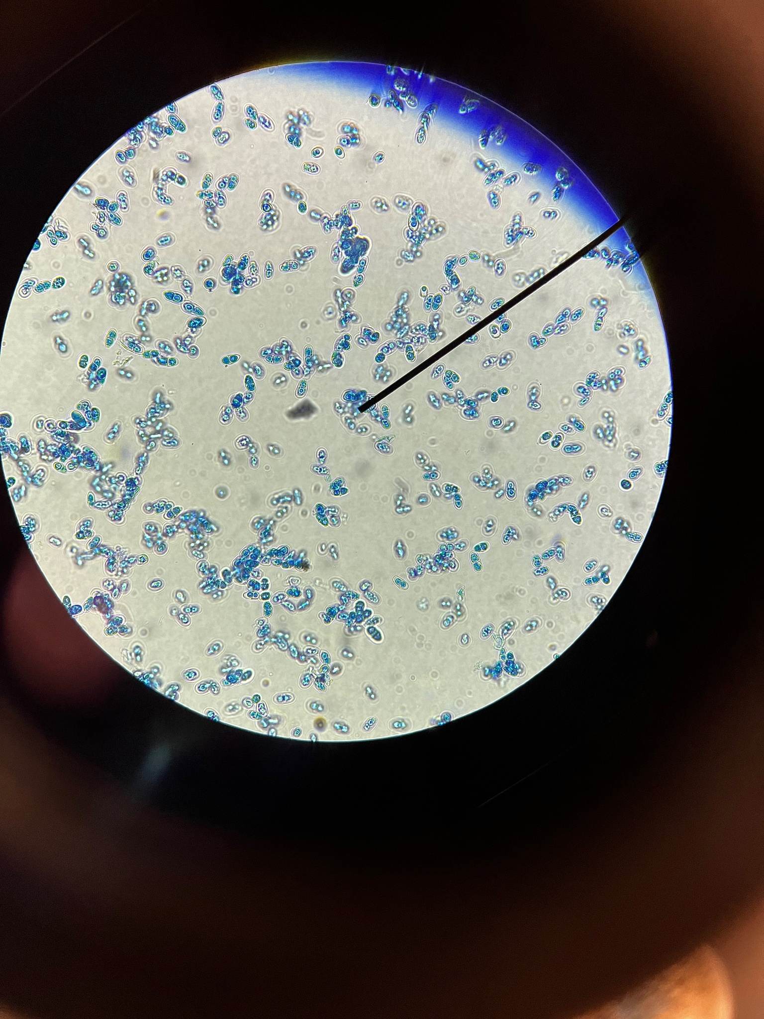 Paecilomyces variotii